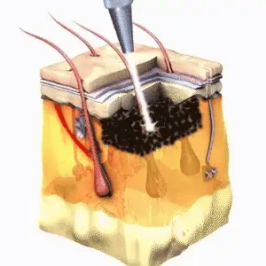 Encabezado