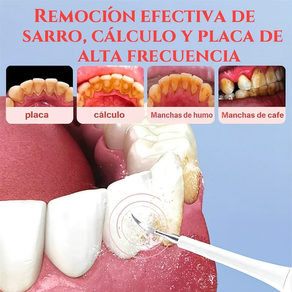 FreshTalk Pro - Limpieza Dental Ultrasónica